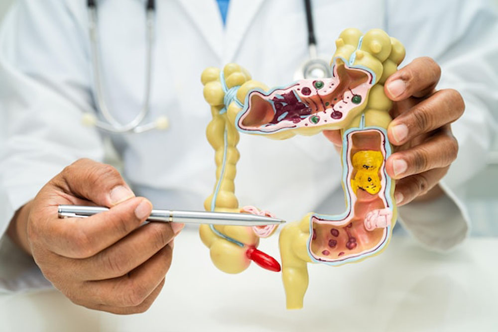 Appendix Meaning in Tamil